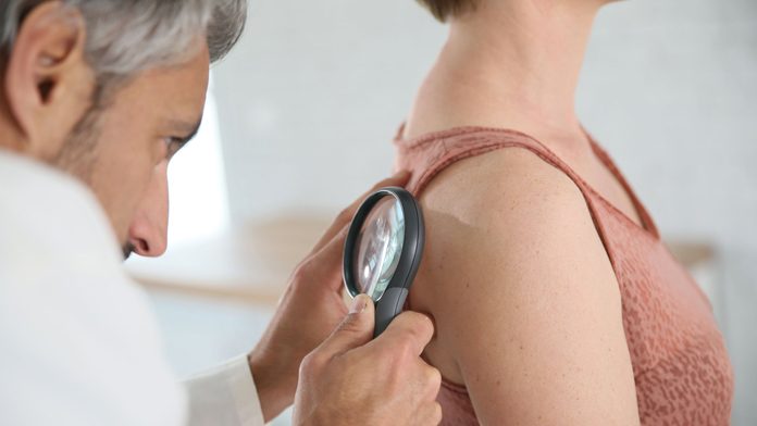 dermatologo mastocistosi dermatologo mastocistosi