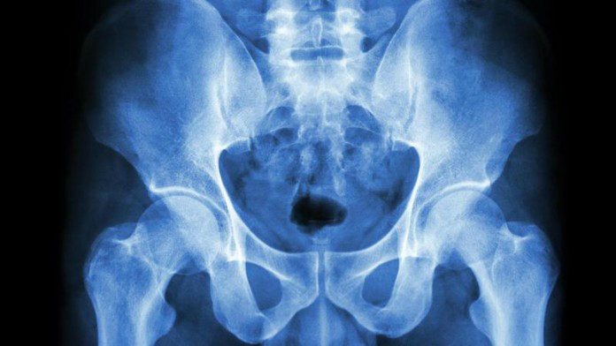 radiografia