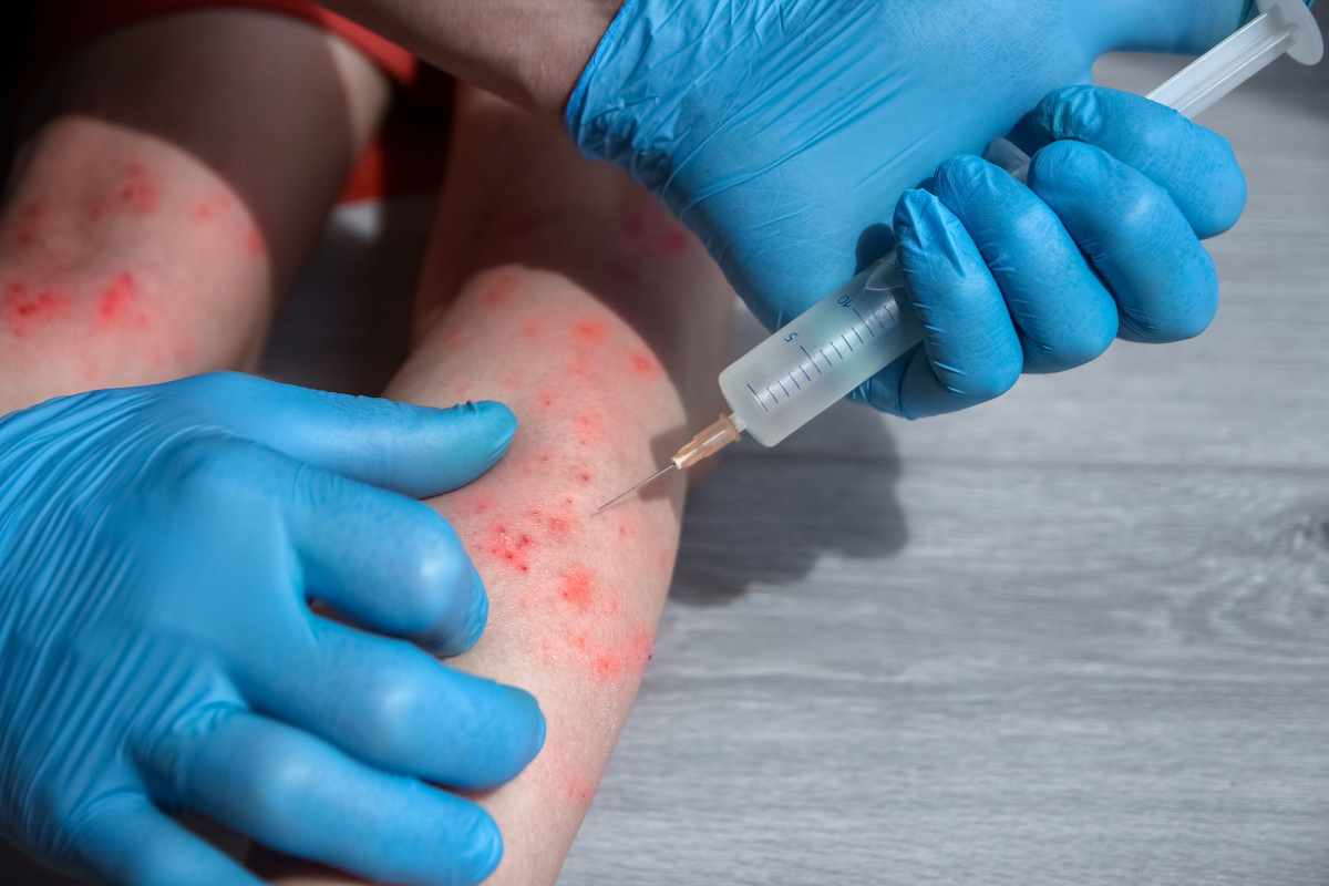 un bambino con bolle curato da un medico 