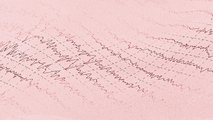 Epilessia quel che c'è da sapere