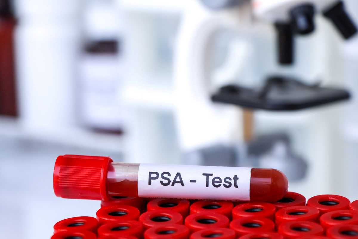 provetta di sangue con etichetta psa test che sta per essere esaminata in laboratorio per check up dopo i 40 anni