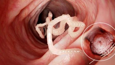ingrandimento di una tenia all'interno dell'intestino