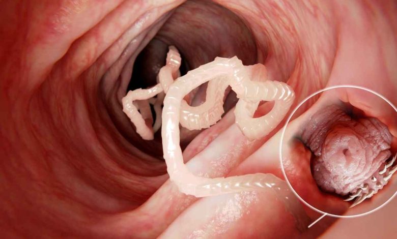 ingrandimento di una tenia all'interno dell'intestino