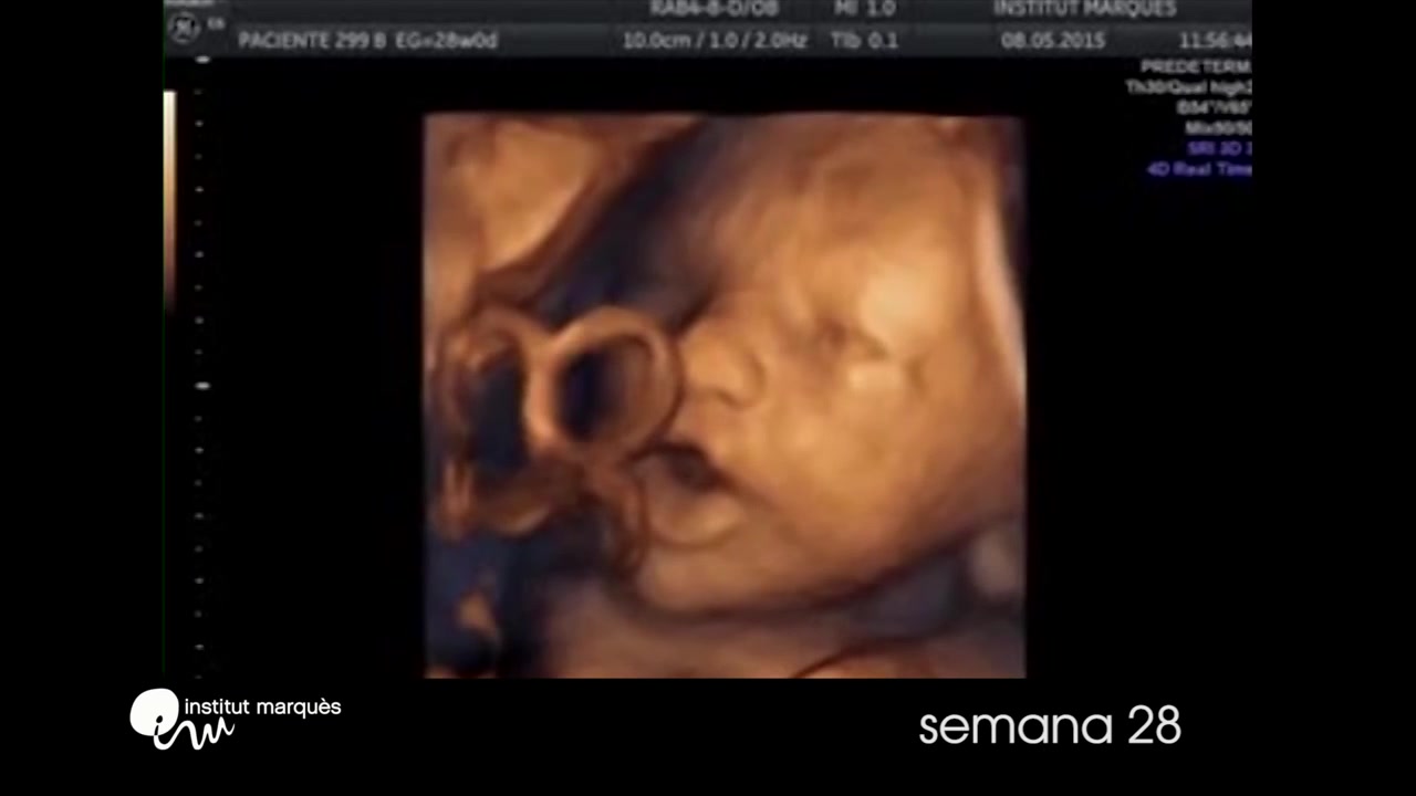 ecografia di un feto