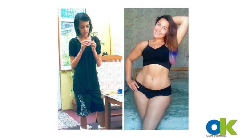 megan-jayne-e-anoressia