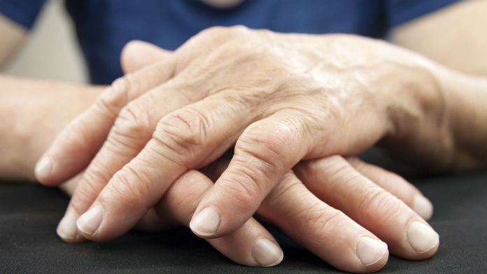 Reumatismi, artrite, artrosi: come si curano le malattie reumatiche