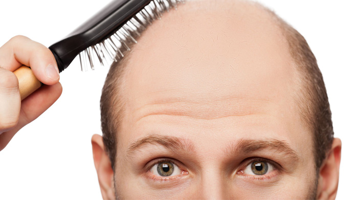 trapianto capelli