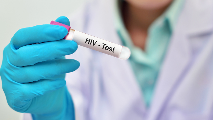 Hiv Test
