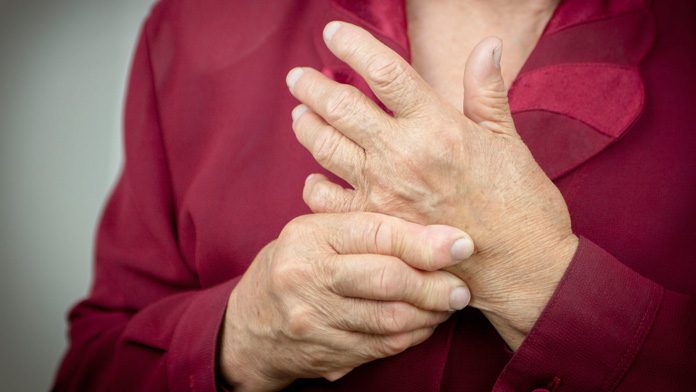 Artrite reumatoide: potrebbe essere causata da un batterio nelle gengive Artrite reumatoide: potrebbe essere causata da un batterio nelle gengive