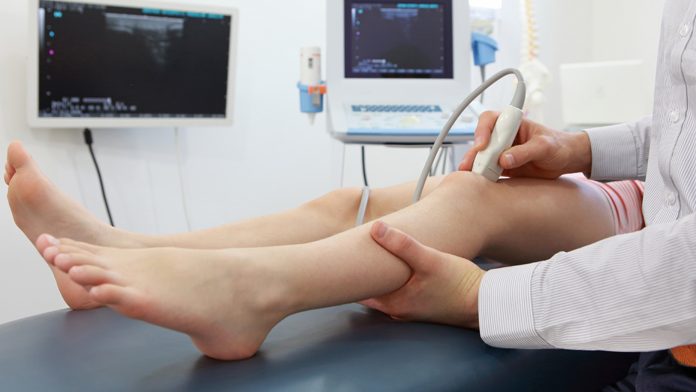 artrite farmaci biologici Artrite reumatoide: ecco quando sospendere i farmaci biologici