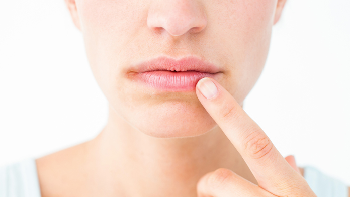 Tagli agli angoli della bocca: cosa sono e perché vengono