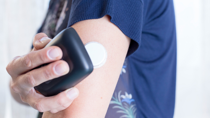 Diabete e glicemia: il sensore oggi è sottocute