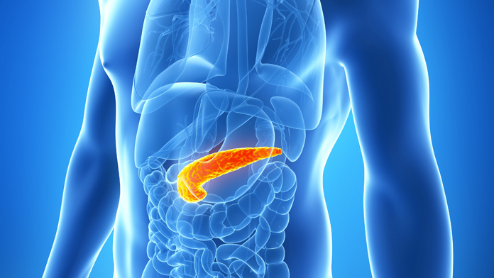 pancreatite acuta