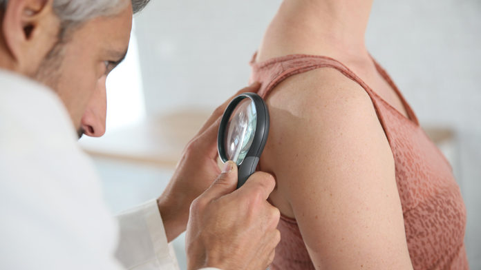 riconoscere-melanoma-rosa Occhio alla pelle: sai riconoscere il melanoma “rosa”?