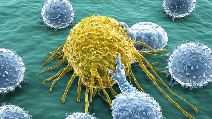 melanoma Melanoma: l'immunoterapia mette il “turbo”