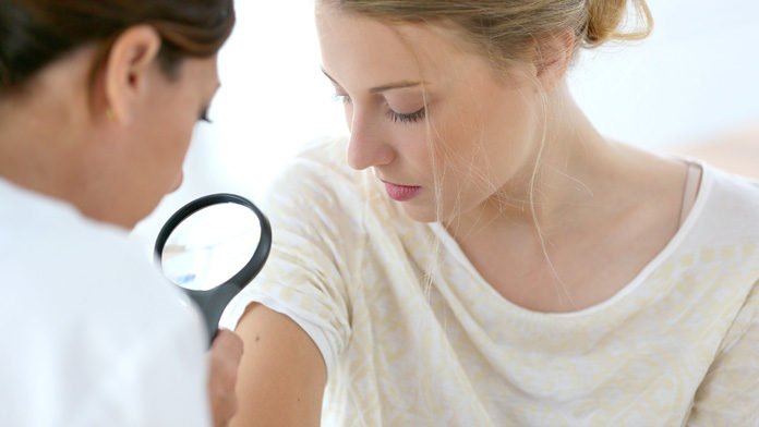 psoriasi Non trascurare la psoriasi: visite e consulenze gratuite nel weekend