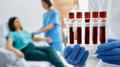 una donna si sottopone a un esame del sangue