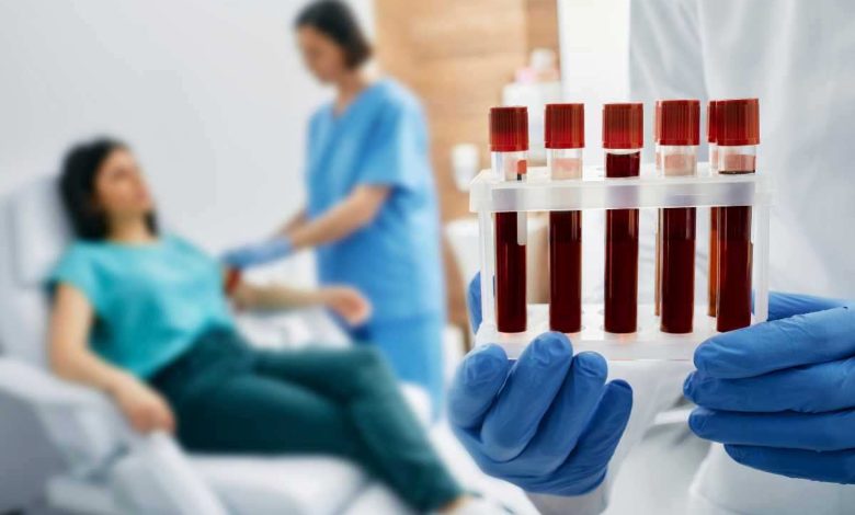 una donna si sottopone a un esame del sangue