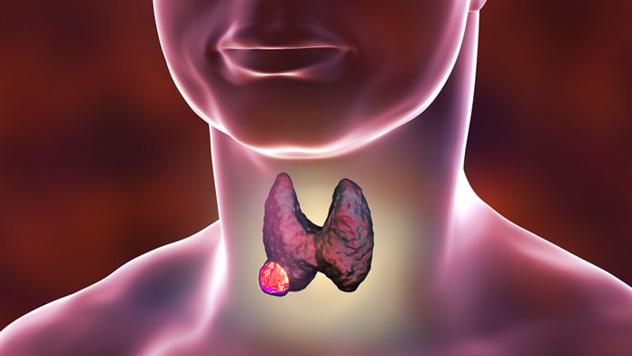 falsi miti sulla tiroide