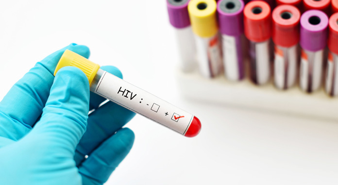 HIV: record di nuovi casi in Europa, l'allarme dell'OMS