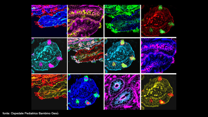 Anche in Italia i primi trapianti di batteri intestinali nei bambini