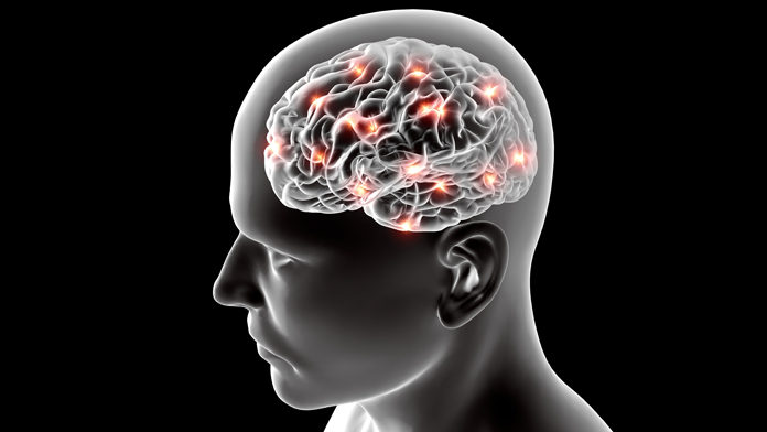 Ischemia cerebrale Ischemia cerebrale