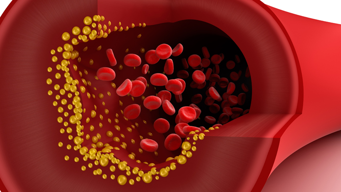 Per i 40-75enni con diabete e LDL di 70