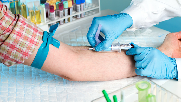 Test sierologico dopo il vaccino