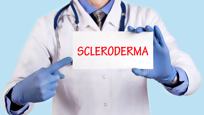 Sclerodermia nuova scoperta