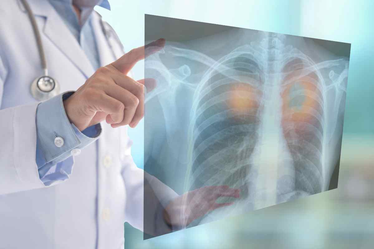 Uno pneumologo esamina i raggi x dei polmoni di un paziente