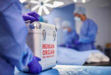una sala operatoria dove si sta per eseguire un trapianto di organo