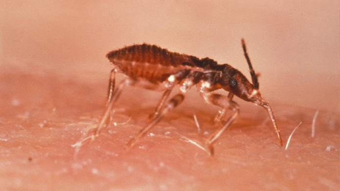 Malattia di Chagas