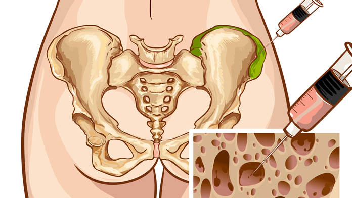 Figura di cellule staminali mesenchimali