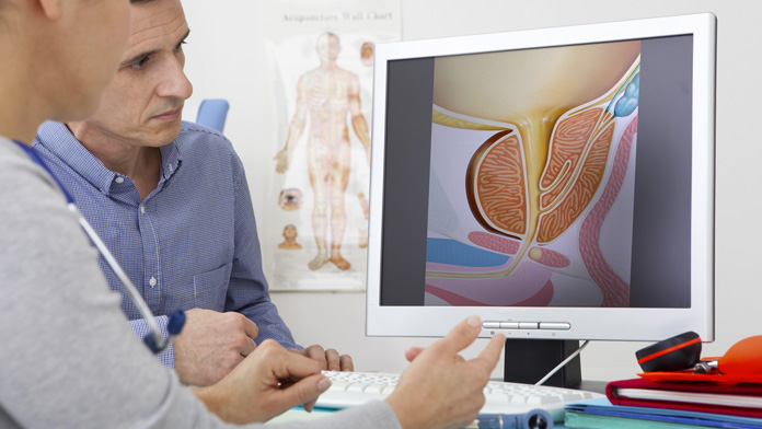 Urologo mostra gli esami della prostata a un paziente