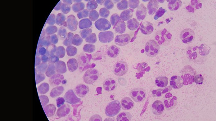Il mistero della Candida auris l'infezione che Il mistero della Candida auris l'infezione che