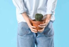 un uomo ha una pianta grassa all'altezza dei glutei per indicare il bruciore