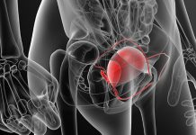 Rischio Prostata Ingrossata Prima Dei 50 Anni I 6 Fattori Piu