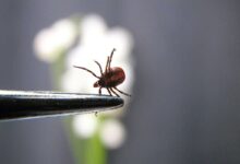 zecca rimossa con una pinzetta