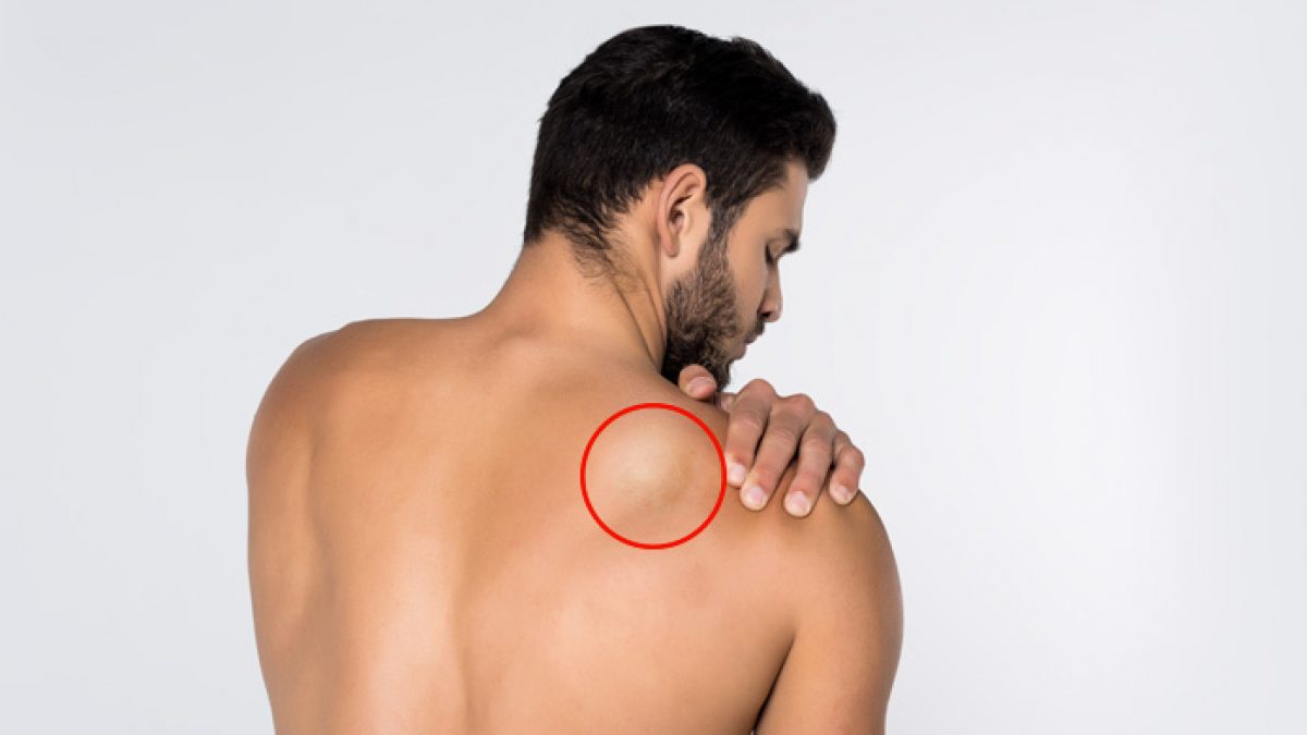 La differenza fondamentale tra massimo spattini steroidi e Google 7 tattiche pratiche per trasformare la massimo spattini steroidi in una macchina di vendita
