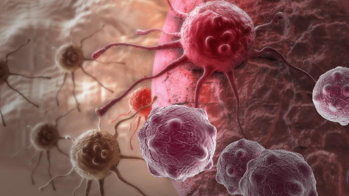 tumore cutaneo a cellule squamose