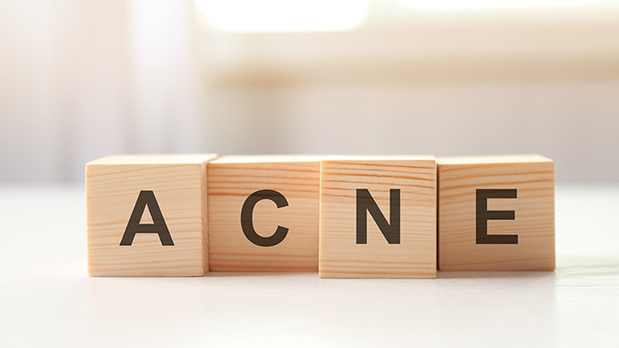 acne - Acne del tronco: la malattia nascosta due volte acne - Acne del tronco: la malattia nascosta due volte
