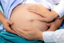 donare cordone ombelicale