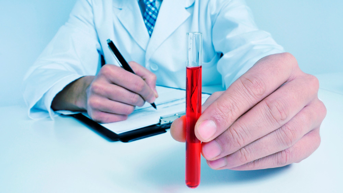 un medico mostra un campione di sangue