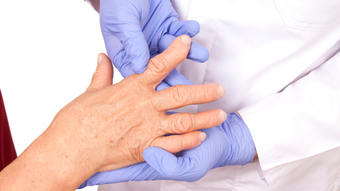 persona con artrite reumatoide a cui danno diagnosi precoce