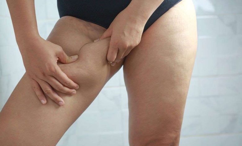 donna che si tocca l'interno coscia con entrambe le mani mostrando il grasso in eccesso