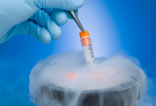 crioconservazione degli ovociti