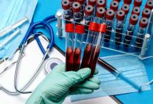 campioni di sangue per ricercare proteine cancro
