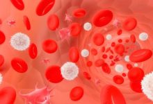 car t per leucemia mieloma