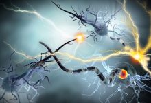 epilessie rare e complesse quali terapie ci sono