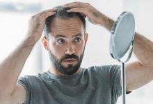 farmaci anti obesità fanno perdere i capelli alle donne